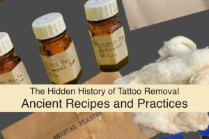 A History of Tattoo Removal Methods